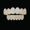 Classic Iced Out Grillz